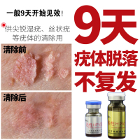 元荣尖锐克疣草本去疣老茧除跖疣祛瘊子HPV肉刺寻常疣湿疣趾疣脸上扁平疣瘊疣净鸡瘊立康周氏滴液鸡液眼膏湿疣药面部刺瘊克疣液