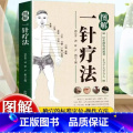 【单册】图解一针疗法 【正版】图解一针疗法 针虽细物道通神 上合于天下合人 中医学教程书籍 针灸疗法穴位中医临床腧穴定疗