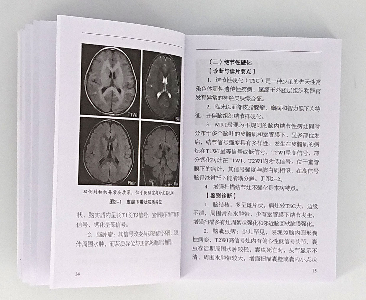 [醉染正版]临床实用MRI掌中宝 科学、简明、实用的临床宝典 正版 书籍 医学 口袋书读片指南mri手册医学影像诊断系高清大图