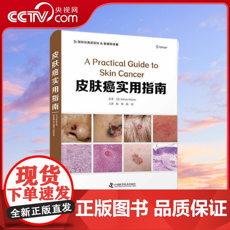 【央视网】皮肤癌实用指南 总结性表格与图片 能帮助读者快速掌握皮肤癌相关知识及治疗方法 ZK