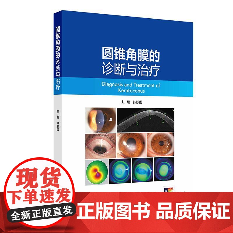 圆锥角膜的诊断与治疗 陈跃国 主编 圆锥角膜的流行病学 角膜地形图特征 供眼科医生及医学生阅读参考97871173716高清大图