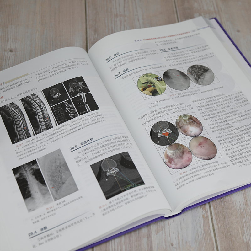 [正版] 全内镜脊柱外科学 脊柱内镜脊柱疼痛内窥镜应用脊柱病外科学书籍 经皮脊柱内镜手术脊柱疾病手术技巧指导书籍
