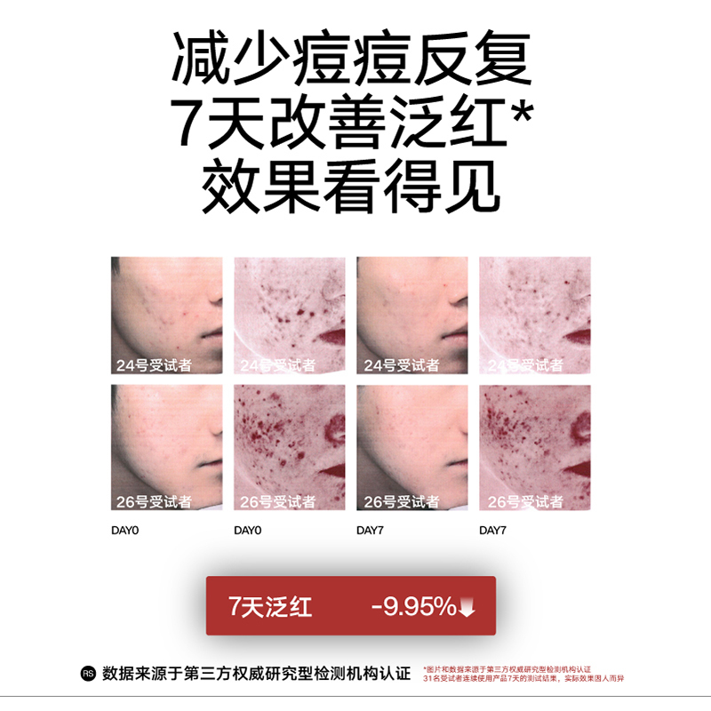 理然男士洗面奶抗痘洁面温和清洁控油清爽不紧绷改善痘痘洁面乳