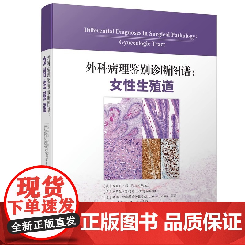 [央视网]外科病理鉴别诊断图谱 女性生殖道 172个鉴别诊断表格和1596幅高清典型病理图片相结合 医学外科学书籍 BJ高清大图