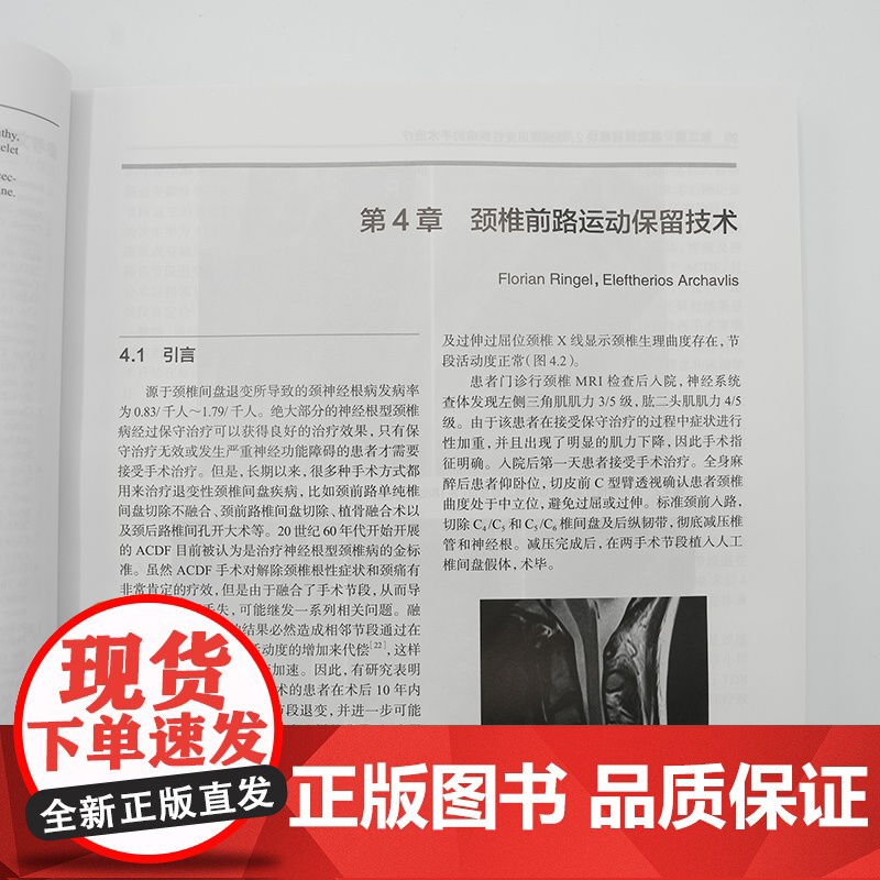 脊柱外科 临床思辨与病例点评 马晓生 主编 该书配有大量清晰的病例影像学资料 可以帮助读者迅速理解相关内容 人民卫生出版高清大图