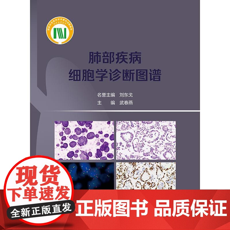 肺部疾病细胞学诊断图谱 武春燕 介绍了肺部疾病的液基细胞学诊断方法 呼吸科肿瘤科病理科等相关专业临床医务人员 人民卫生出高清大图