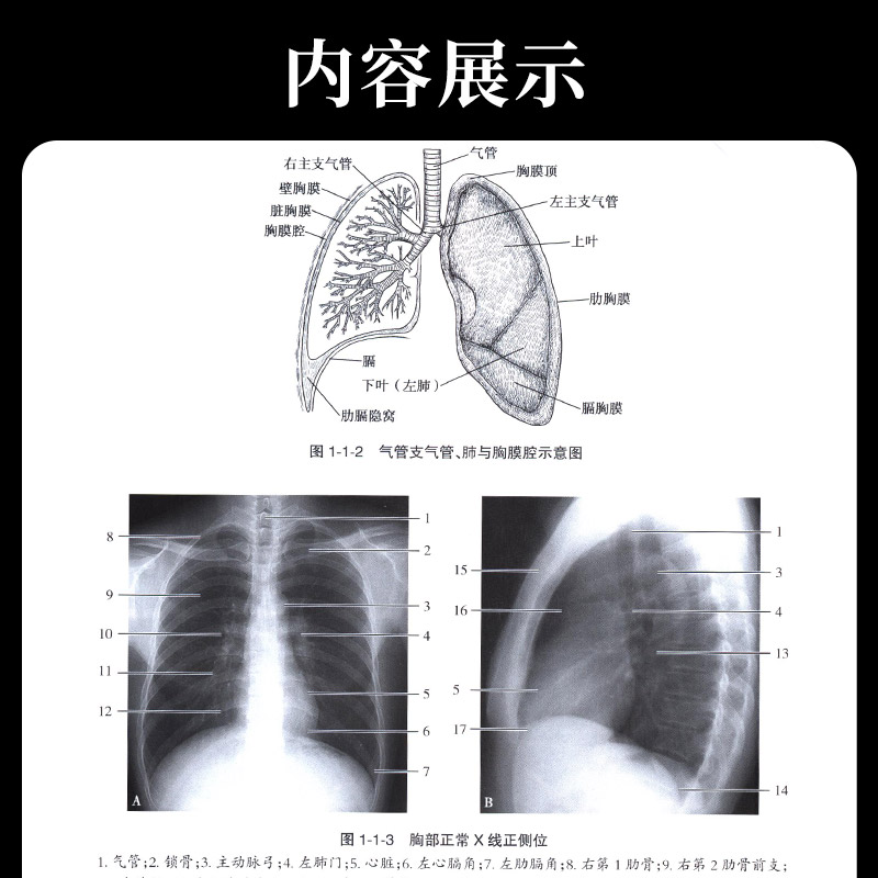 [正版]医学影像学读片诊断图谱胸部分册 头颈胸腹骨肌部放射医学超声诊断学影像解剖学胸部影像学x线读片指南磁共振ct诊断高清大图