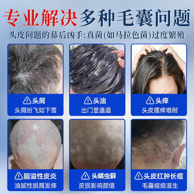 南京同仁堂去屑止痒洗发水去屑控油毛囊清洁滋养头皮蓬松清爽男女士洗发露高清大图