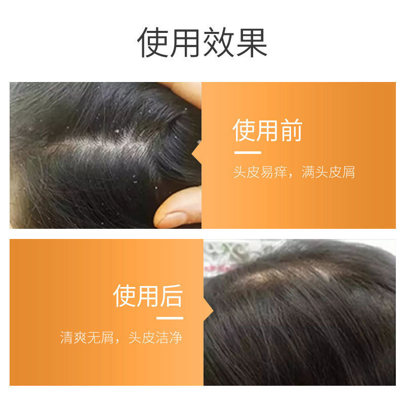 安安金纯洗发水 银杏去屑柔顺洗发露1L装 止痒控油洗头膏 滋养顺滑洗发乳 家庭装 男女通用