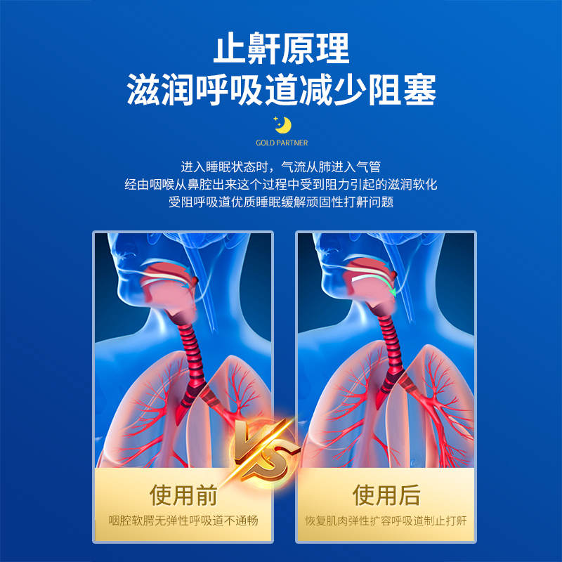 修正止鼾器防打呼噜专用消打鼾液体治阻喷剂睡觉疗男士神器915