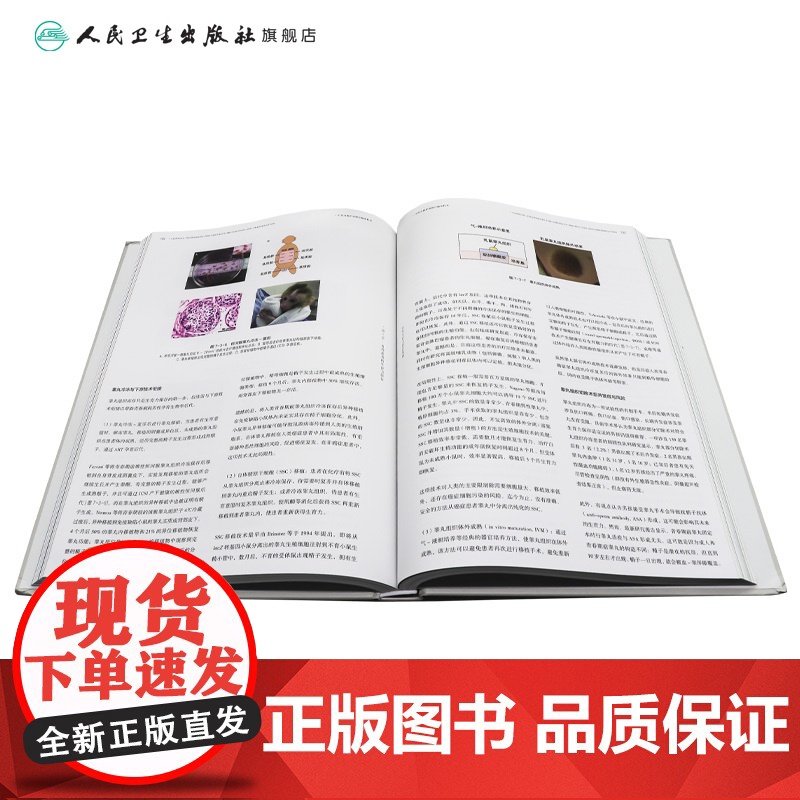 生育力保护及保存临床技术 主编梁晓燕 肿瘤患者的生育力保护 男性患者的生育力保存 儿童患者的生育力保存 97871173高清大图