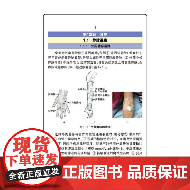 儿童血管通路管理高清大图