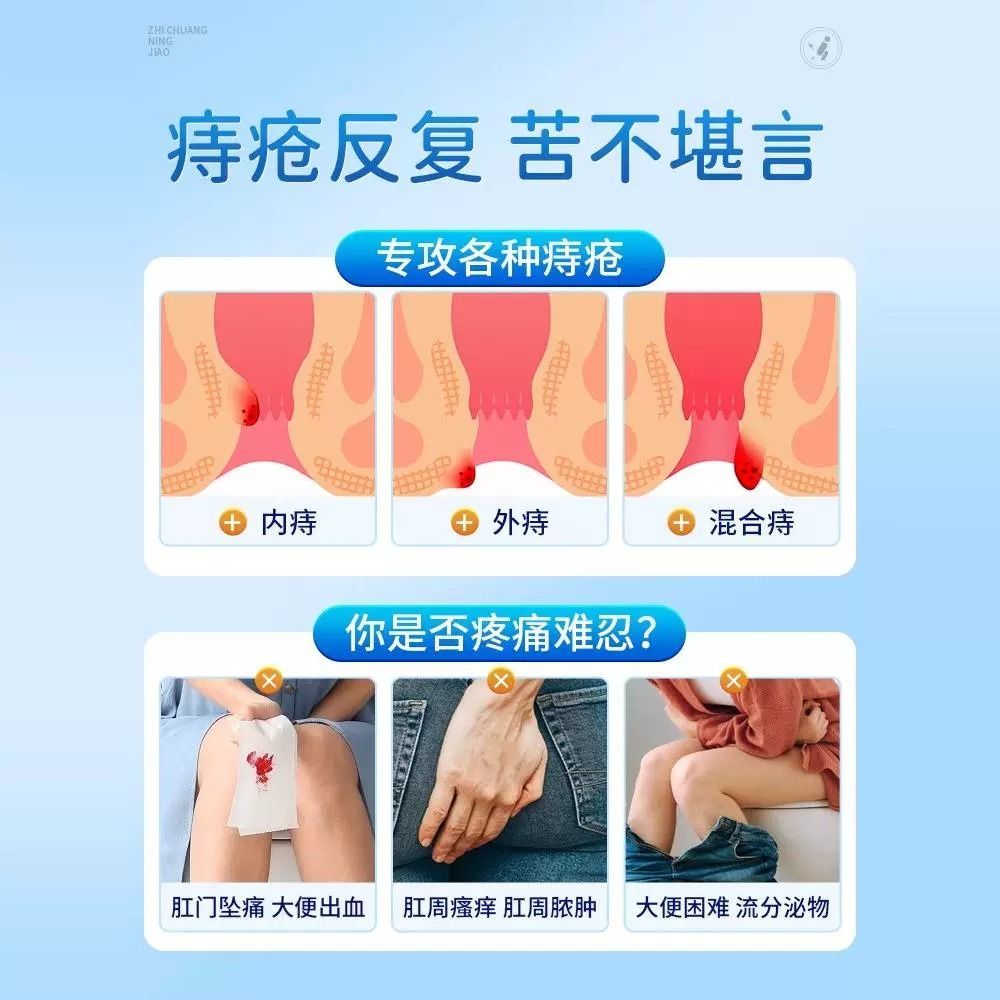 [1盒装 ]北京同仁堂医用痔疮膏消痔凝胶消肉球内外混合痔肛门瘙痒男女正品高清大图
