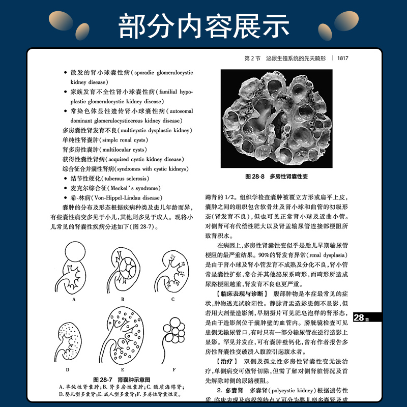 [正版] 诸福棠实用儿科学 第9版 全2册 儿科新生儿是要保健症状鉴别诊断参考书籍 人民卫生出版社 978711732高清大图