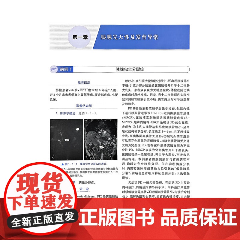 胰腺疑难与罕见病例:影像与病理 邵成伟 边云 蒋慧 精选135例胰腺疑难与罕见病例 深度融合影像与病理资料 上海科学技术高清大图