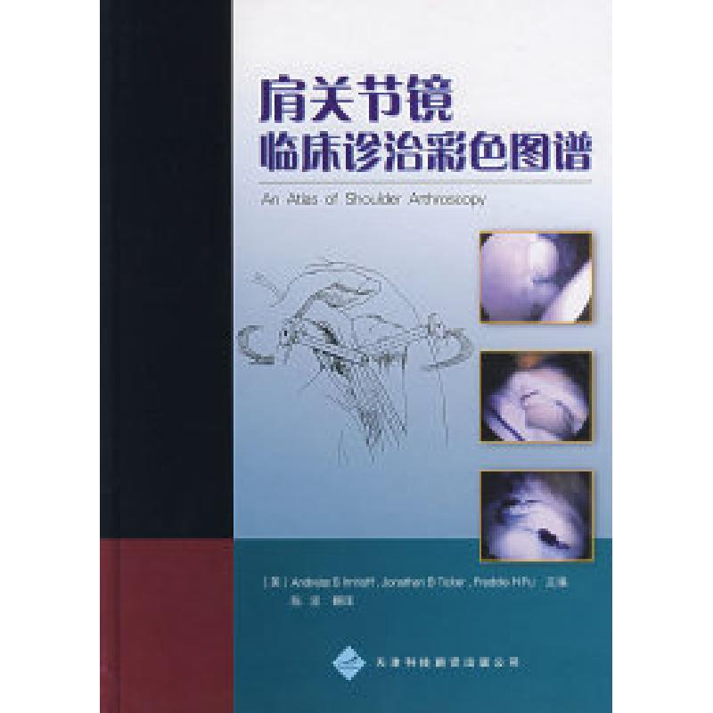 正版新书]肩关节镜临床诊治彩色图谱(美)安缀斯 陈坚978754332高清大图