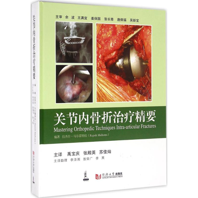 [M]关节内骨折治疗精要-9787560863184高清大图