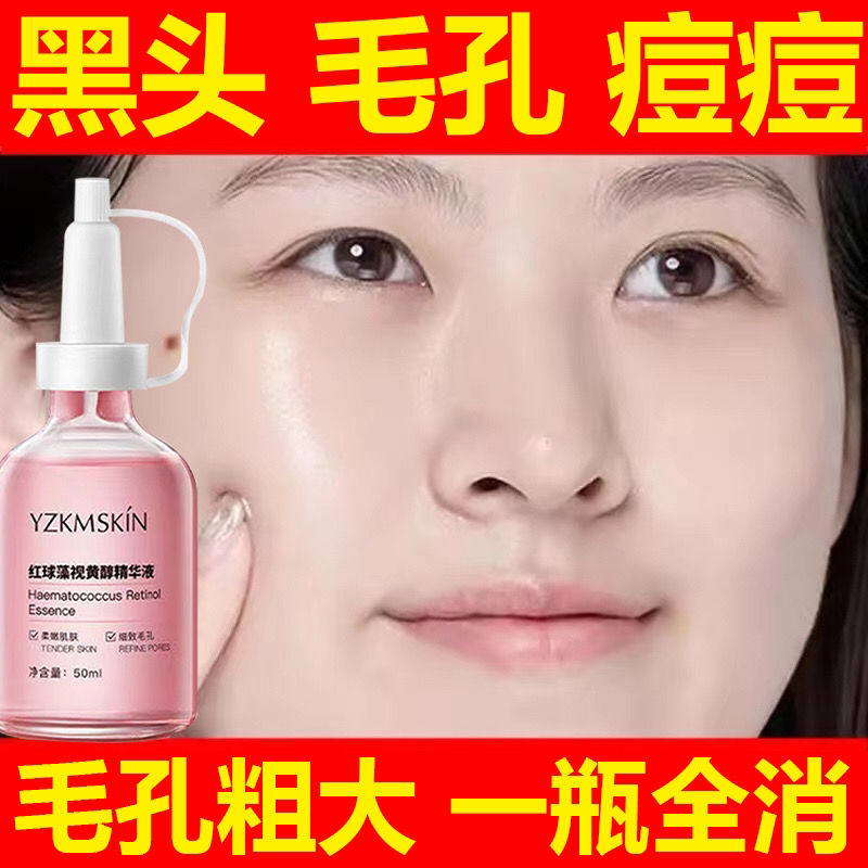 毛孔精华水1瓶装 收缩毛孔精华液修复毛孔粗大去黑头痘痘粉刺缩小毛孔男女学生党