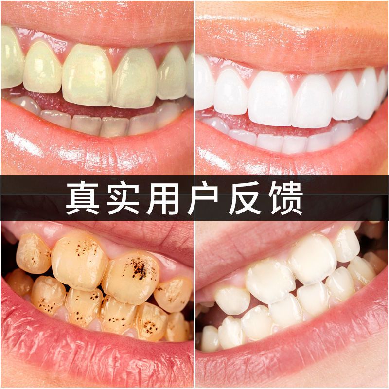 洗牙粉牙齿美白去黄洗白污垢除牙石刷洁牙结石烟牙渍去除牙黄神器 牙粉1盒/50g[体验装]