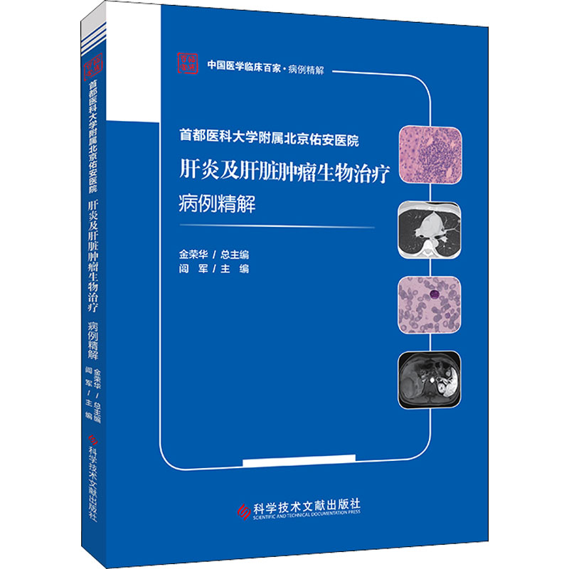 [正版]首都医科大学附属北京佑安医院肝炎及肝脏肿瘤生物治疗病例精解 闾军 编 内科学疾病诊治资料图书 医学类书籍 科学技高清大图