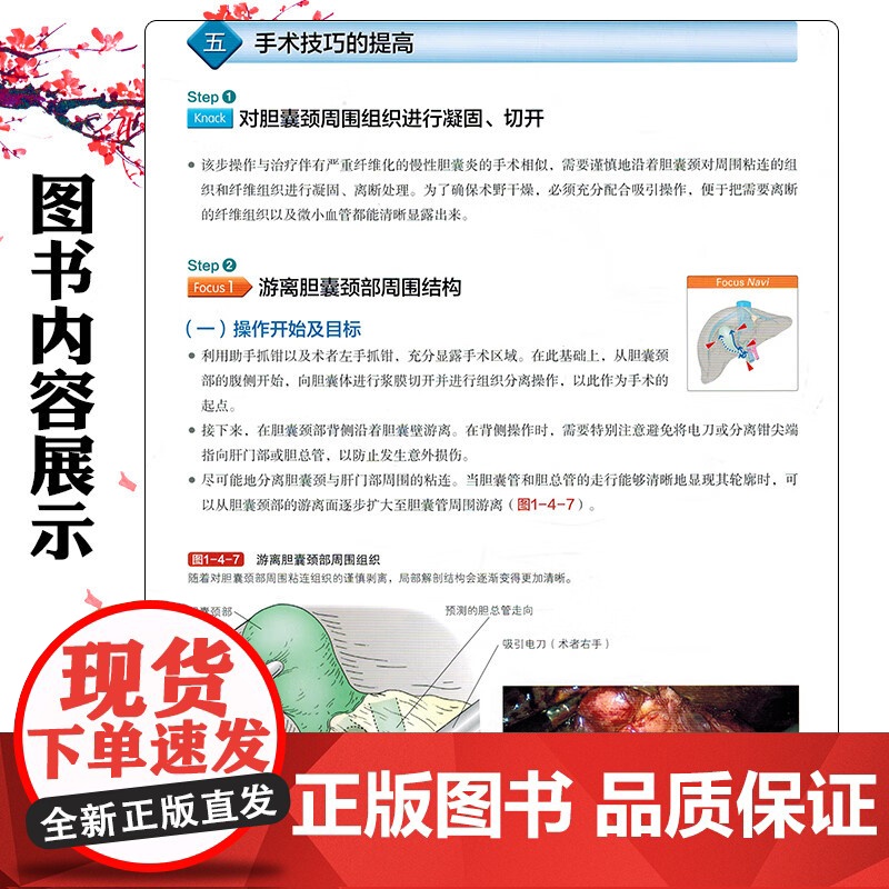 良性及急诊手术的标准腹腔镜治疗. 肝胆胰脾·腹壁篇 辽宁科学技术出版社9787559141019高清大图