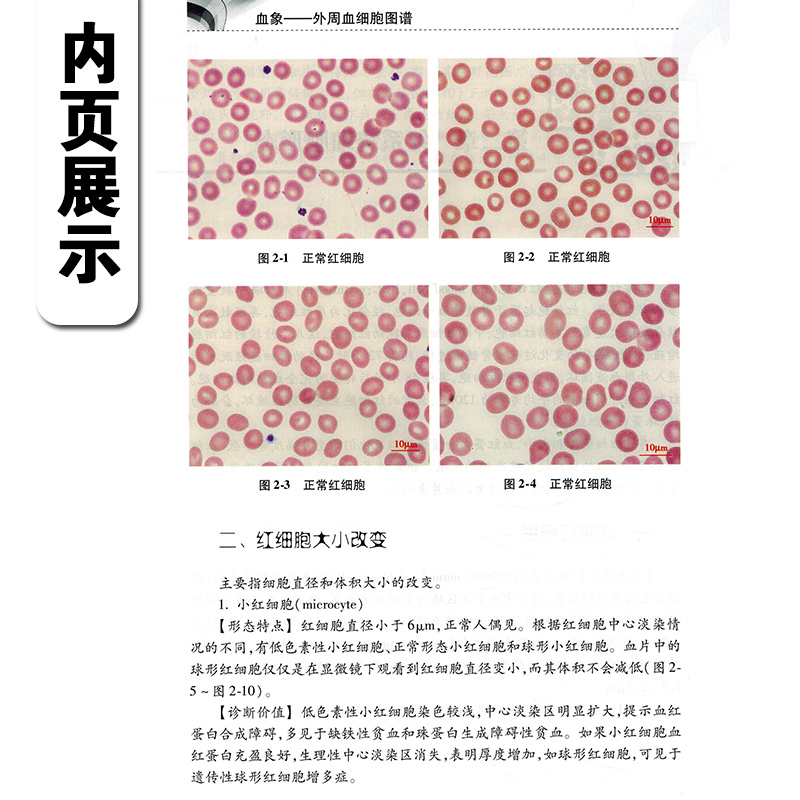 [正版] 血象外周血细胞图谱 主编张时民 王庚 外周血细胞形态学检验技术 临床血液病学参考工具书籍 人民卫生出版社97高清大图