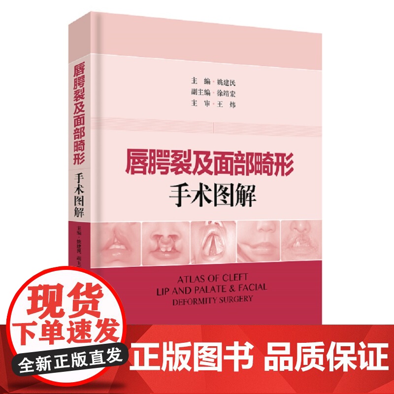 唇腭裂及面部畸形手术图解 姚建民 整形外科/口腔外科/美容外科及耳鼻喉科临床医师常用参考工具书 上海科学技术出版社高清大图