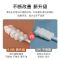 婴儿口腔清洁器新生儿乳牙纱布牙刷宝宝舌苔洗舌头用品0-1-2-3岁 试用装[10支装]