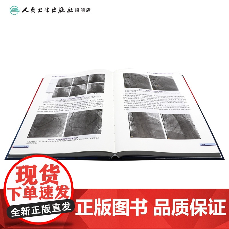 心脏起搏技术第二版华伟阜外心血管内科学介入心脏病学心内科心脏起搏除颤心律失常冠脉介入人民卫生出版社内科学心脏电生理高清大图