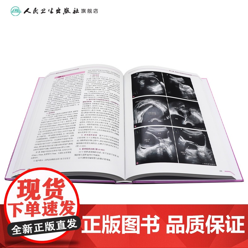 梗阻性子宫阴道发育异常超声和手术对比诊断 子宫阴道的超声检查和正常表现 主编王慧芳 秦成路 9787117369015人高清大图