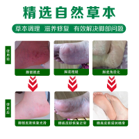栢年足康脚气喷剂脚臭脚汗脚气药脚气克星喷脚净喷雾有效去除脚臭脚痒脚脱皮脚汗烂脚丫不复发