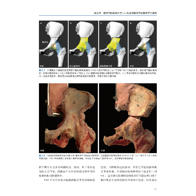 正版新书]髋关节发育不良的认识与治疗[加拿大]保罗·E.博莱(Paul高清大图
