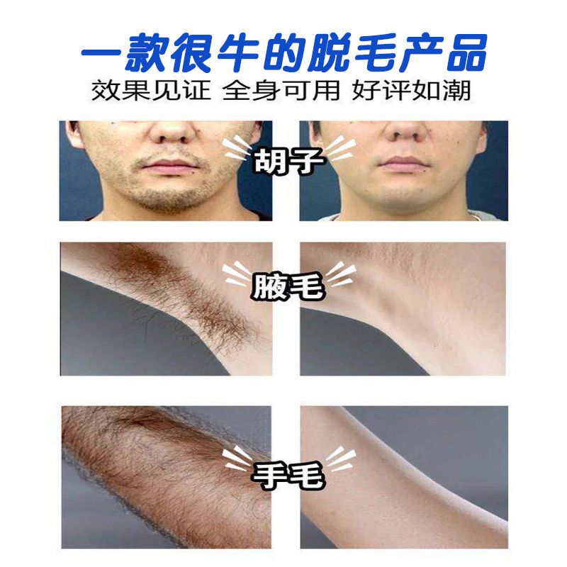 [男士专业去胡子]脱毛膏去胡须男士脸部毛腿毛腋下手毛全身脱毛 QMG