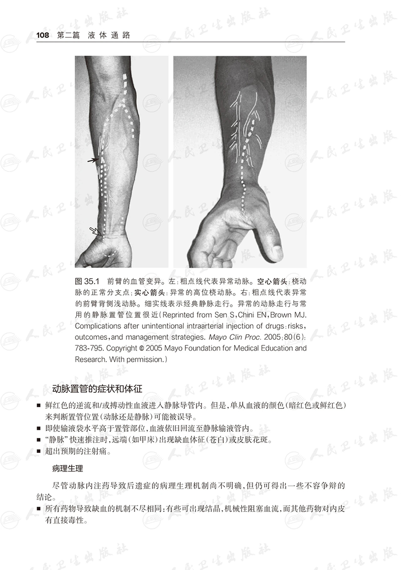 [正版]避免麻醉常见错误 冯艺主译 基本临床操作技术 重点手术类型麻醉管理中易错内容 麻醉师经验心得集锦 人民卫生出版高清大图