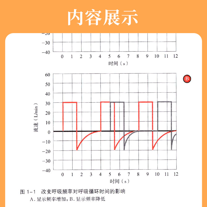 [正版]呼吸机波形快速解读 中文翻译第2版 美 乔纳森·B·沃 等编呼吸机书籍常见临床病症新生儿通气波临床医学ICU和高清大图
