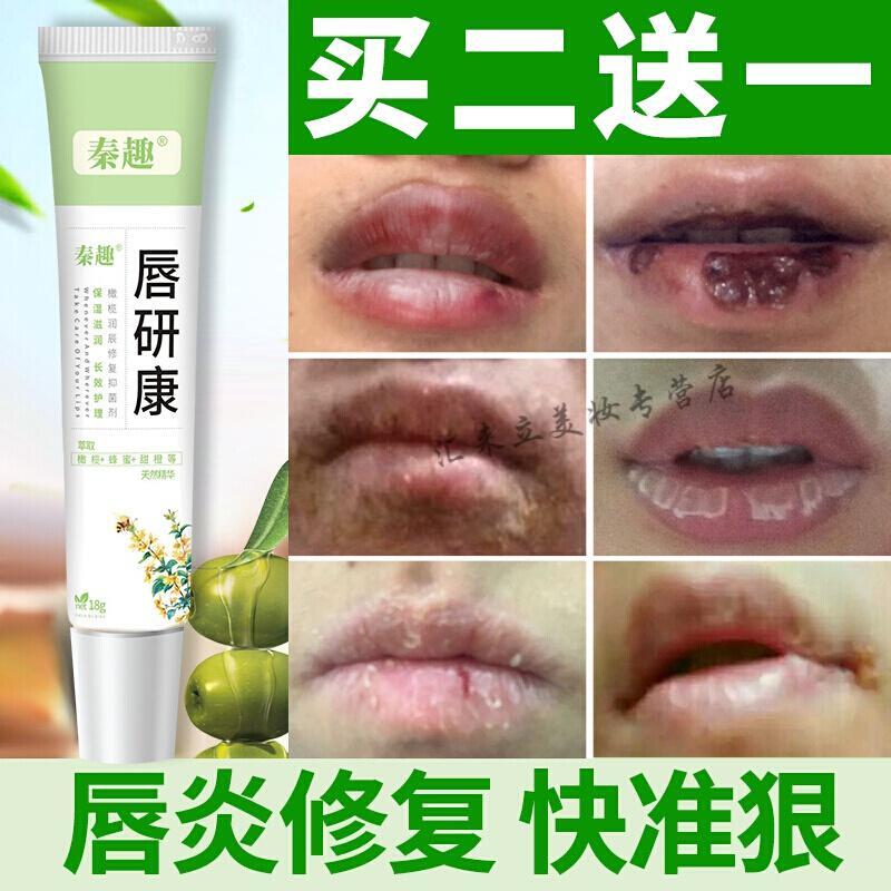 起泡嘴角开裂润唇油jilinsha【价格 图片 品牌 报价】-苏宁易购臻尚美