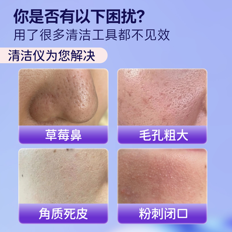 MAGITECH刮黑头铲美容院去黑头神器电动超声波清洁吸美容仪家用仪器粉刺铲皮机2418高清大图