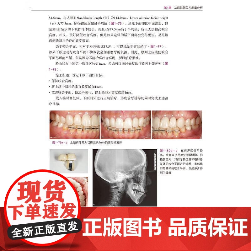 [出版社]口腔综合修复策略 咬合功能重建 土屋贤司著 种植修复口腔咬合治疗修复治疗策略种植体咬合变化 辽宁科学技术出版社高清大图