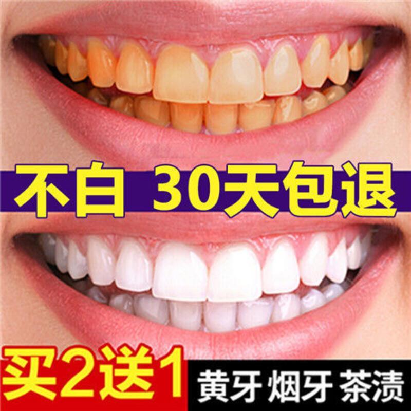 壹宝洗牙粉牙齿美白神器去牙结石祛除去牙垢洁牙粉美白去黄牙渍 一盒