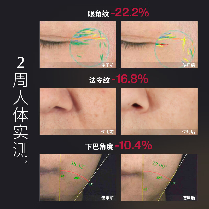 AMIRO觅光 红光三棱美容仪 V脸美容仪器 家用眼面部射频仪深层紧致提拉淡纹-黑 ARF001LD!高清大图
