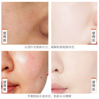 欧佩(OU PEI)烟酰胺保湿精华液15ml 补水保湿祛黄提亮肤色面部男女