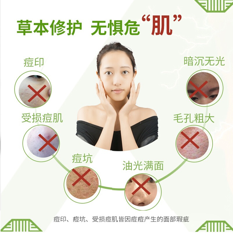 同仁堂祛痘膏套装男女祛痘产品(祛痘洁面100g+祛痘精华30g+祛痘膏30g)草本配方控油补水