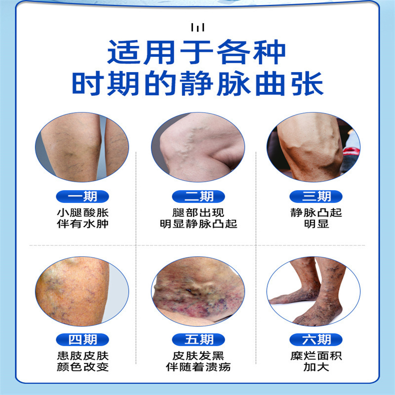 [3盒装]药房直售 脉适康(高效型) 静脉曲张冷敷凝胶正品青筋凸起腿部医外用时珍世家冷凝胶高清大图
