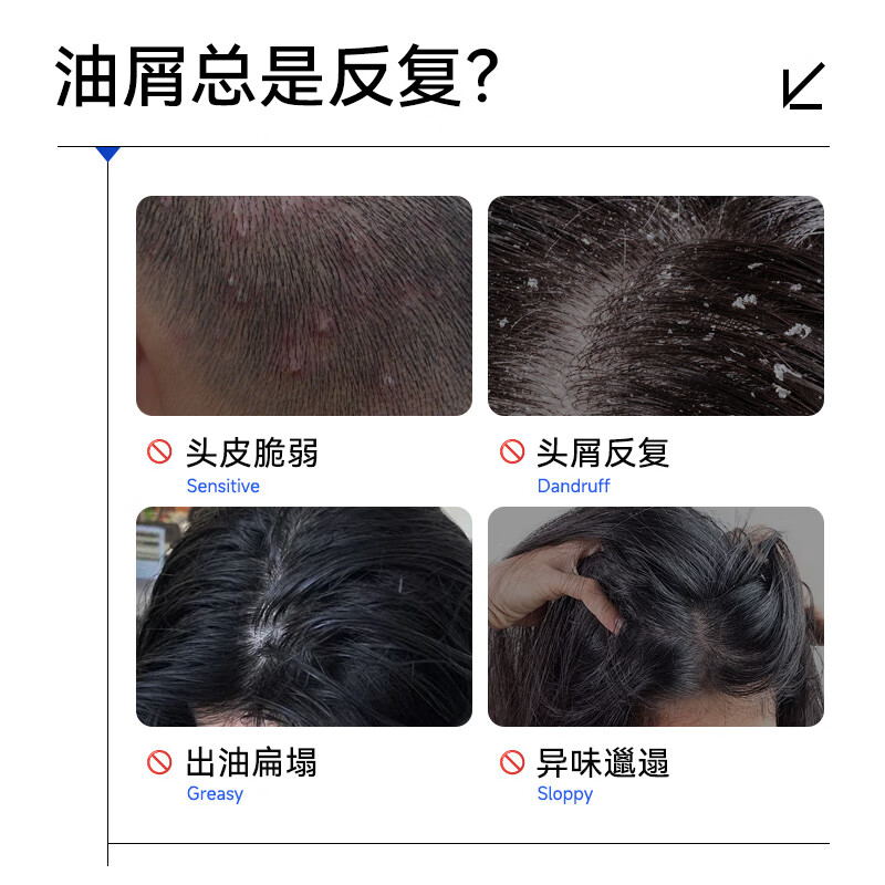 满婷(MANTING)氨基酸表活控油去屑洗发乳450ml高清大图