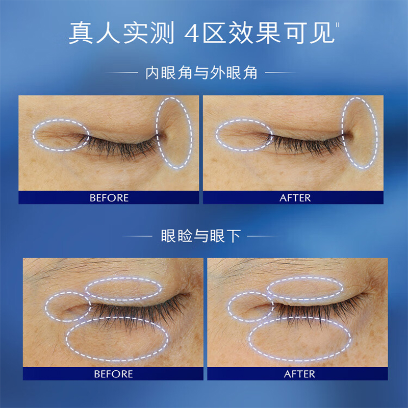 雅诗兰黛(Estee Lauder) 特润修护肌活精华眼霜(小棕瓶眼霜)第五代15ml高清大图