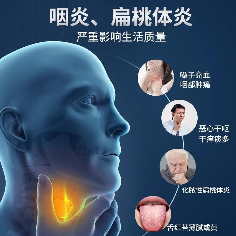 升级款修正感喻官方正品1盒咽扁康咽炎慢性咽喉炎扁桃体发炎肥大咽扁