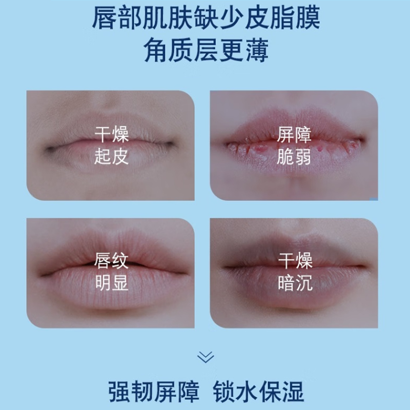 凡士林(VASELINE) 经典修护保湿男士润唇膏清爽薄荷味3.5g高清大图