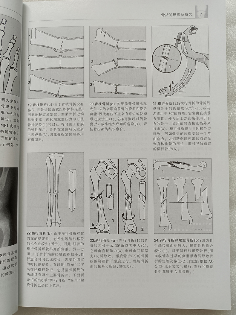 [正版]实用骨折治疗指南第5版 麦克雷 骨科医学类专业书籍 骨外科手术学诊断与治疗图书 外科学书籍 天津科技翻译出版公司高清大图