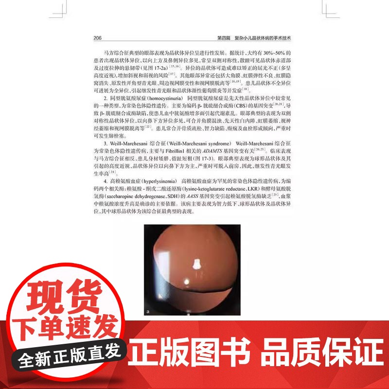 小儿晶状体病学 陈伟蓉主编 小儿晶状体病诊疗知识参考书小儿晶状体病学眼科白内障视功能重建眼科学书籍临床表现治疗手术 儿科高清大图