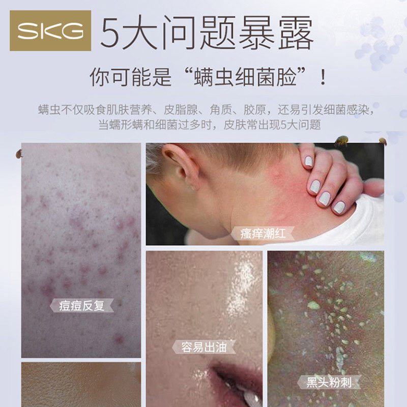 SKG 等离子嫩肤仪3627 家用脸部清洁杀菌除螨净痘控油保湿（9月30日-10月4日订单，10月5日陆续发货）
